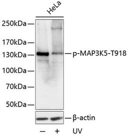 Western blot - Phospho-MAP3K5-T918 antibody (AP0061)