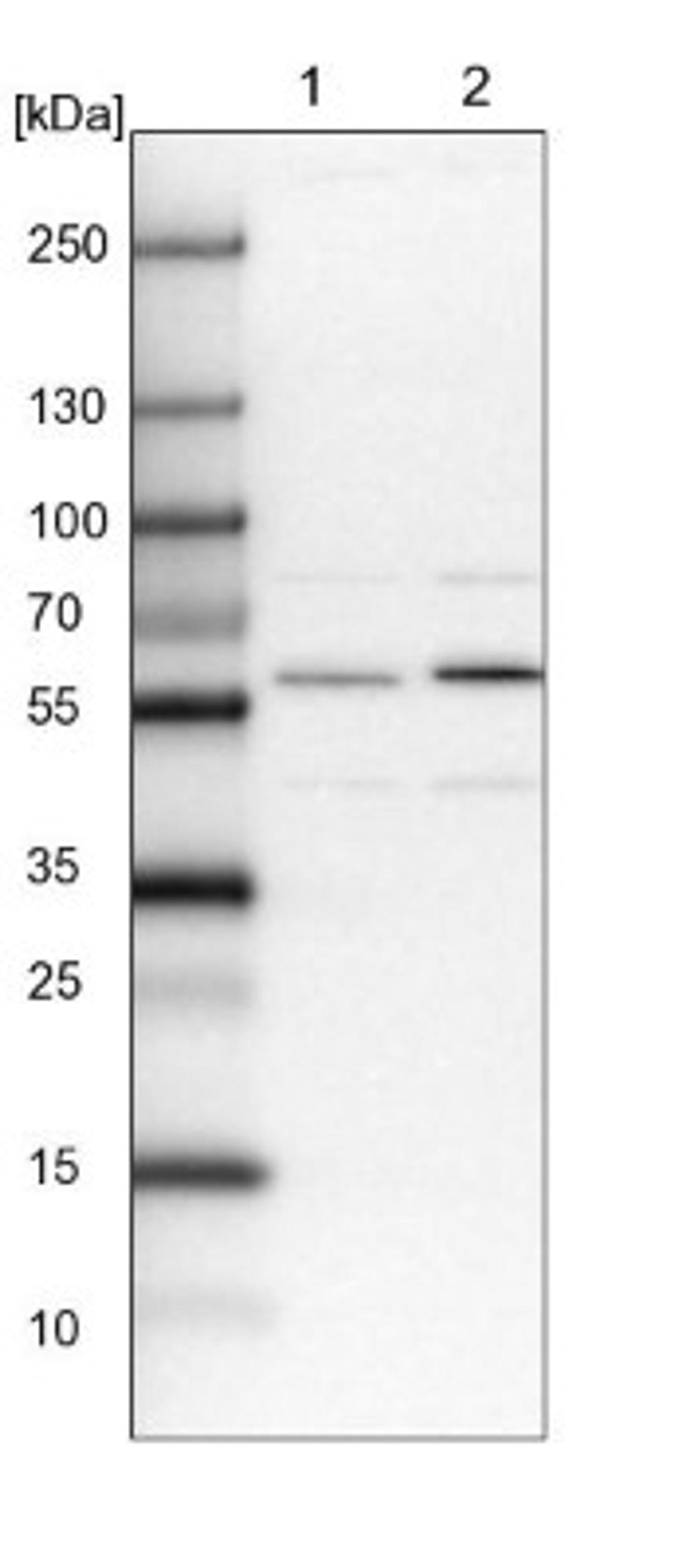 Western Blot: FAM178B Antibody [NBP1-93539] - Lane 1: NIH-3T3 cell lysate (Mouse embryonic fibroblast cells)<br/>Lane 2: NBT-II cell lysate (Rat Wistar bladder tumour cells)