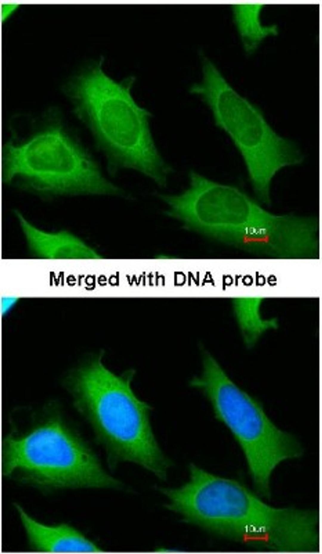 Immunocytochemistry/Immunofluorescence: eRF1 Antibody [NBP1-31113] - Analysis of HeLa, using eRF1 antibody at 1:200 dilution.