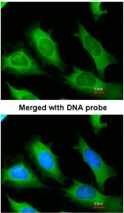 Immunocytochemistry/Immunofluorescence: eRF1 Antibody [NBP1-31113] - Analysis of HeLa, using eRF1 antibody at 1:200 dilution.