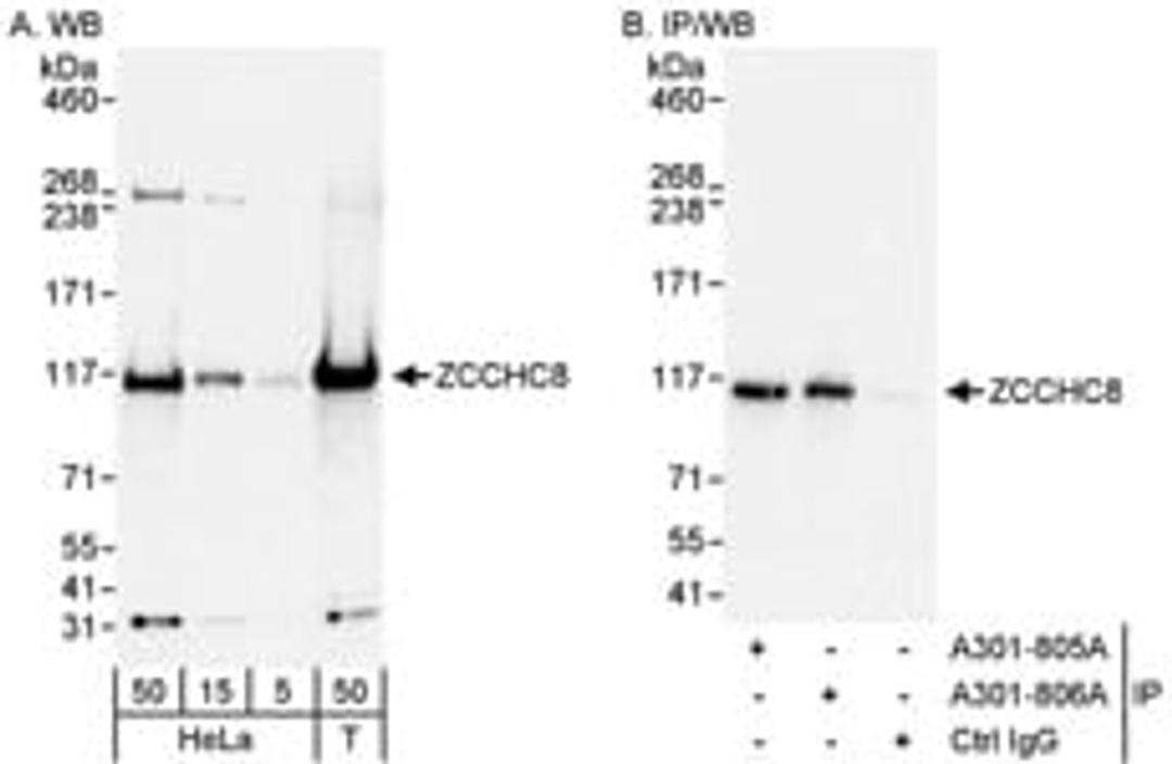 Detection of human ZCCHC8 by western blot and immunoprecipitation.