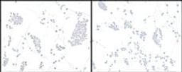 Detection of human HIF2-alpha in FFPE Hep-G2 cells with (left) and without (right) cobalt treatment by ICC.