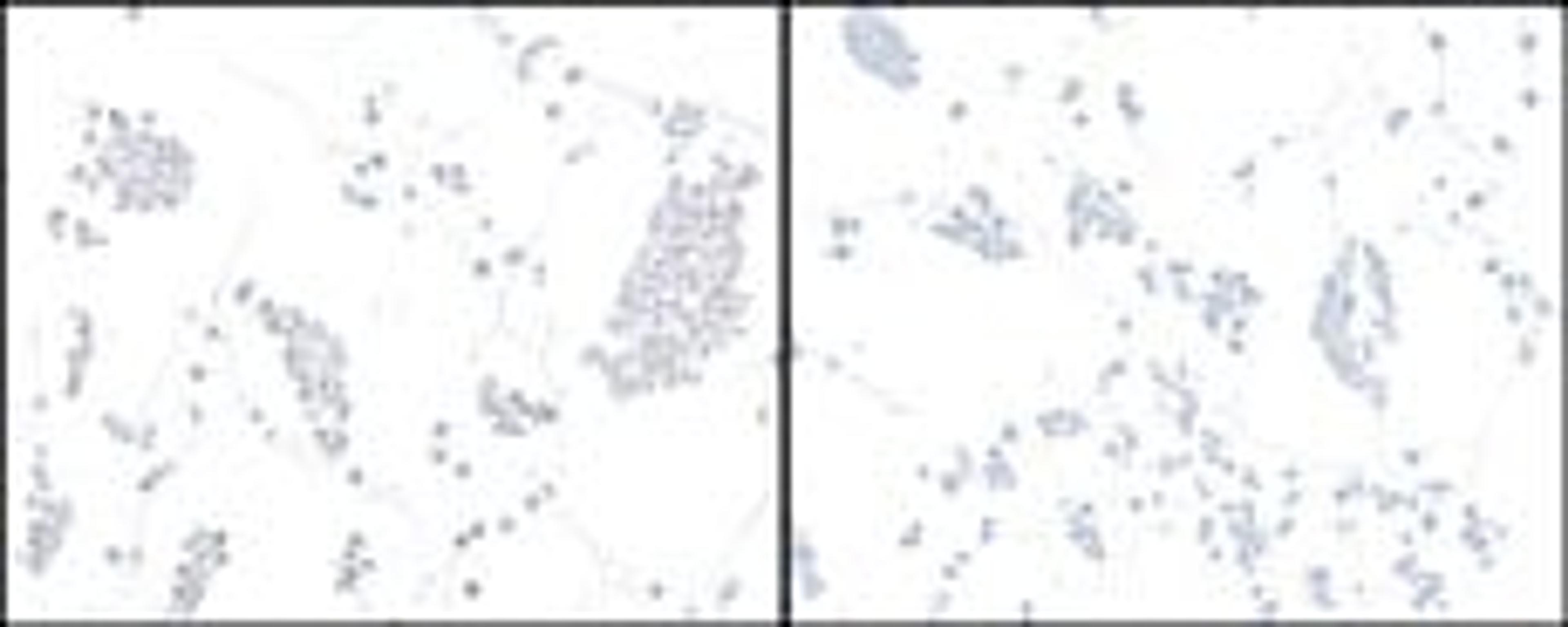 Detection of human HIF2-alpha in FFPE Hep-G2 cells with (left) and without (right) cobalt treatment by ICC.