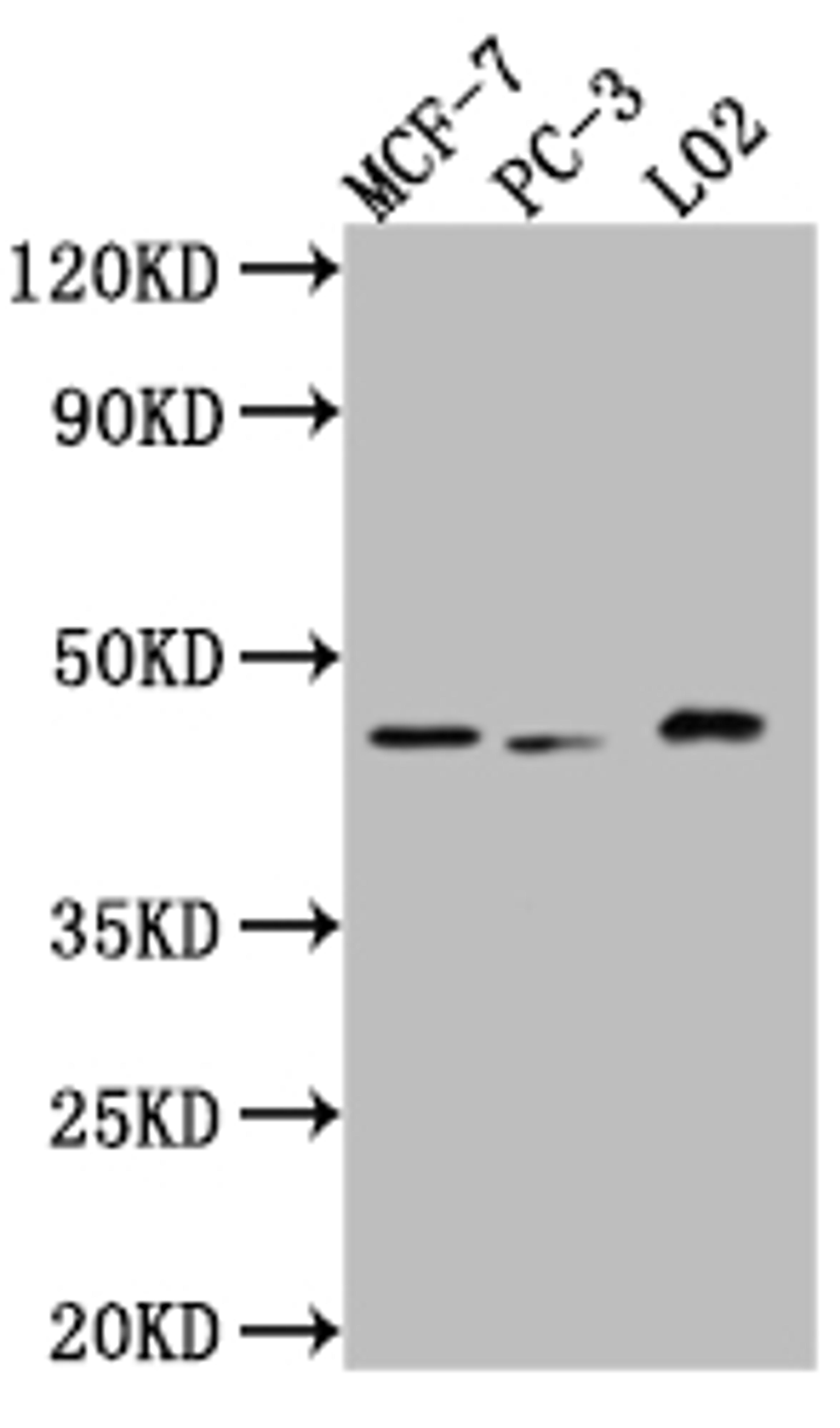 Western Blot. Positive WB detected in: MCF-7 whole cell lysate, PC-3 whole cell lysate, L02 whole cell lysate. All lanes: p38 antibody at 1:1000. Secondary. Goat polyclonal to rabbit IgG at 1/50000 dilution. Predicted band size: 42, 42, 35, 36 kDa. Observed band size: 42 kDa. 