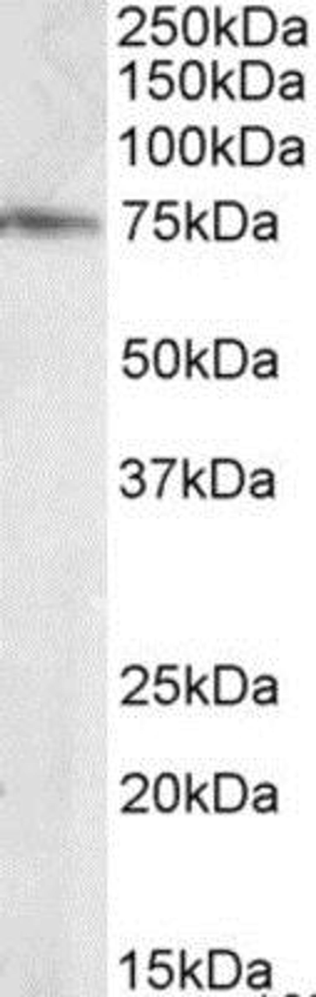 Western Blot: ELMO3 Antibody [NB100-873] - (0.1ug/ml) of Human Brain (Hipoocampus) lysate (RIPA buffer, 35ug total protein per lane). Primary incubated for 1 hour. Detected by chemiluminescence.