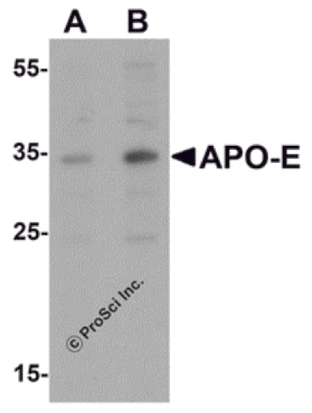 Western blot analysis of APO-E in human brain tissue lysate with APO-E antibody at (A) 0.5 and (B) 1 &#956;g/mL.