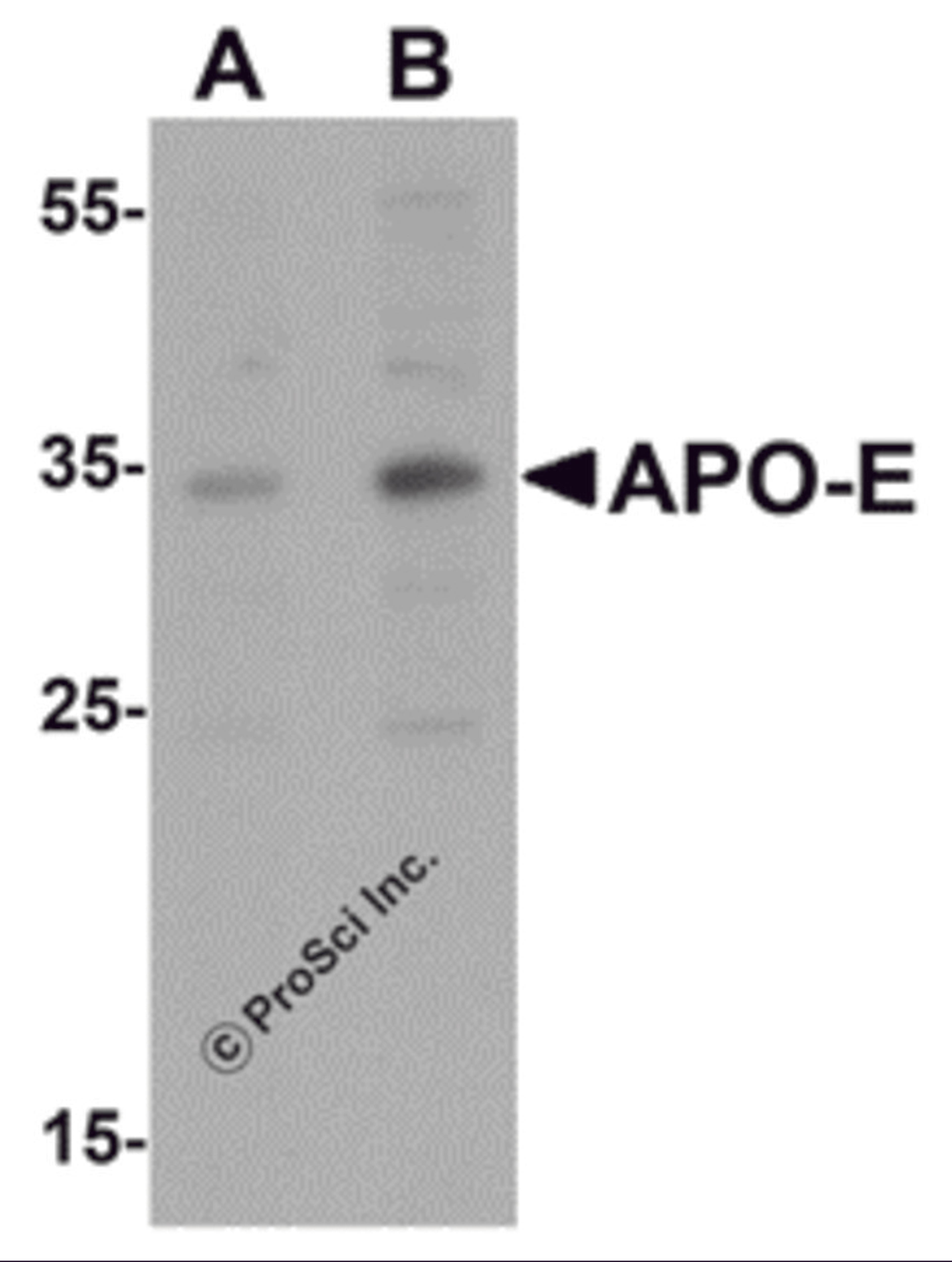 Western blot analysis of APO-E in human brain tissue lysate with APO-E antibody at (A) 0.5 and (B) 1 &#956;g/mL.