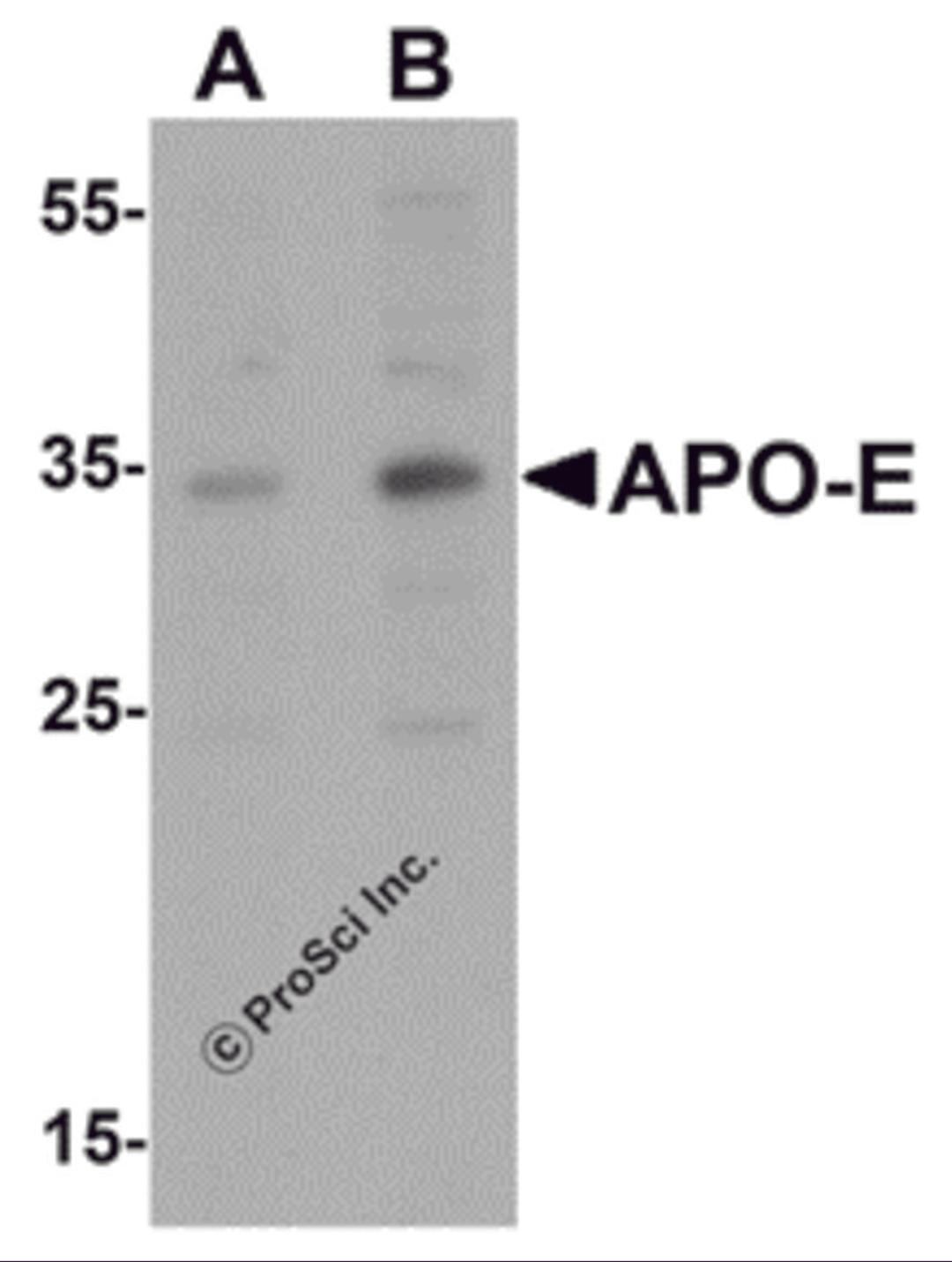 Western blot analysis of APO-E in human brain tissue lysate with APO-E antibody at (A) 0.5 and (B) 1 μg/mL.