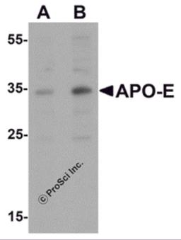 Western blot analysis of APO-E in human brain tissue lysate with APO-E antibody at (A) 0.5 and (B) 1 μg/mL.