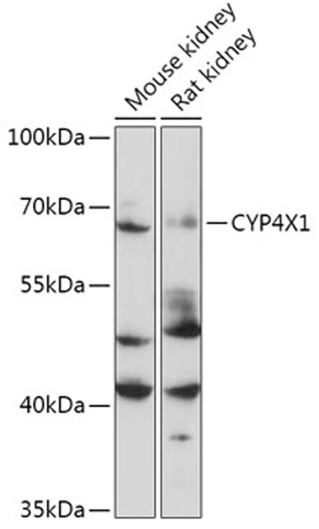 Western blot - CYP4X1 antibody (A17848)