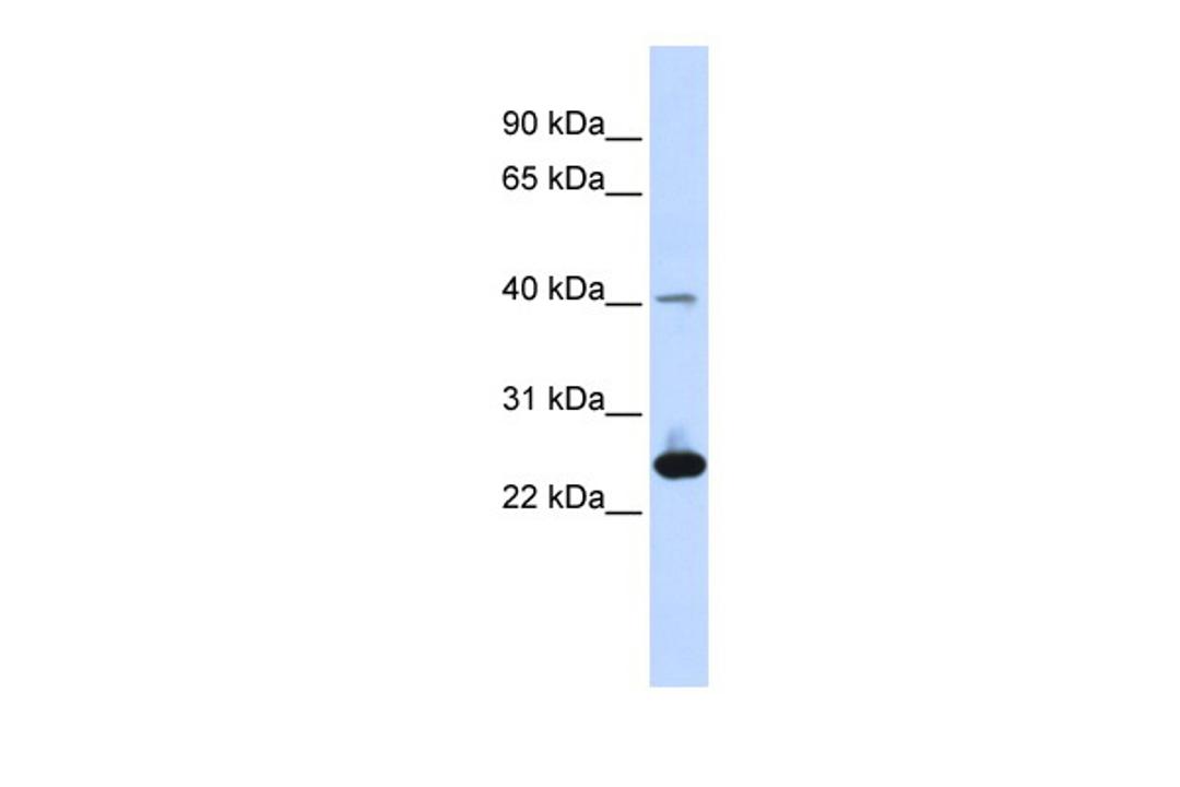 Antibody used in WB on Human Muscle at 0.2-1 ug/ml.