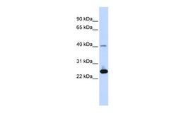 Antibody used in WB on Human Muscle at 0.2-1 ug/ml.