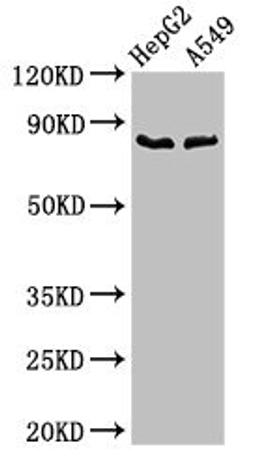 Western Blot. Positive WB detected in: HepG2 whole cell lysate, A549 whole cell lysate. All lanes: CFB antibody at 2.8ug/ml. Secondary. Goat polyclonal to rabbit IgG at 1/50000 dilution. Predicted band size: 86 kDa. Observed band size: 86 kDa.
