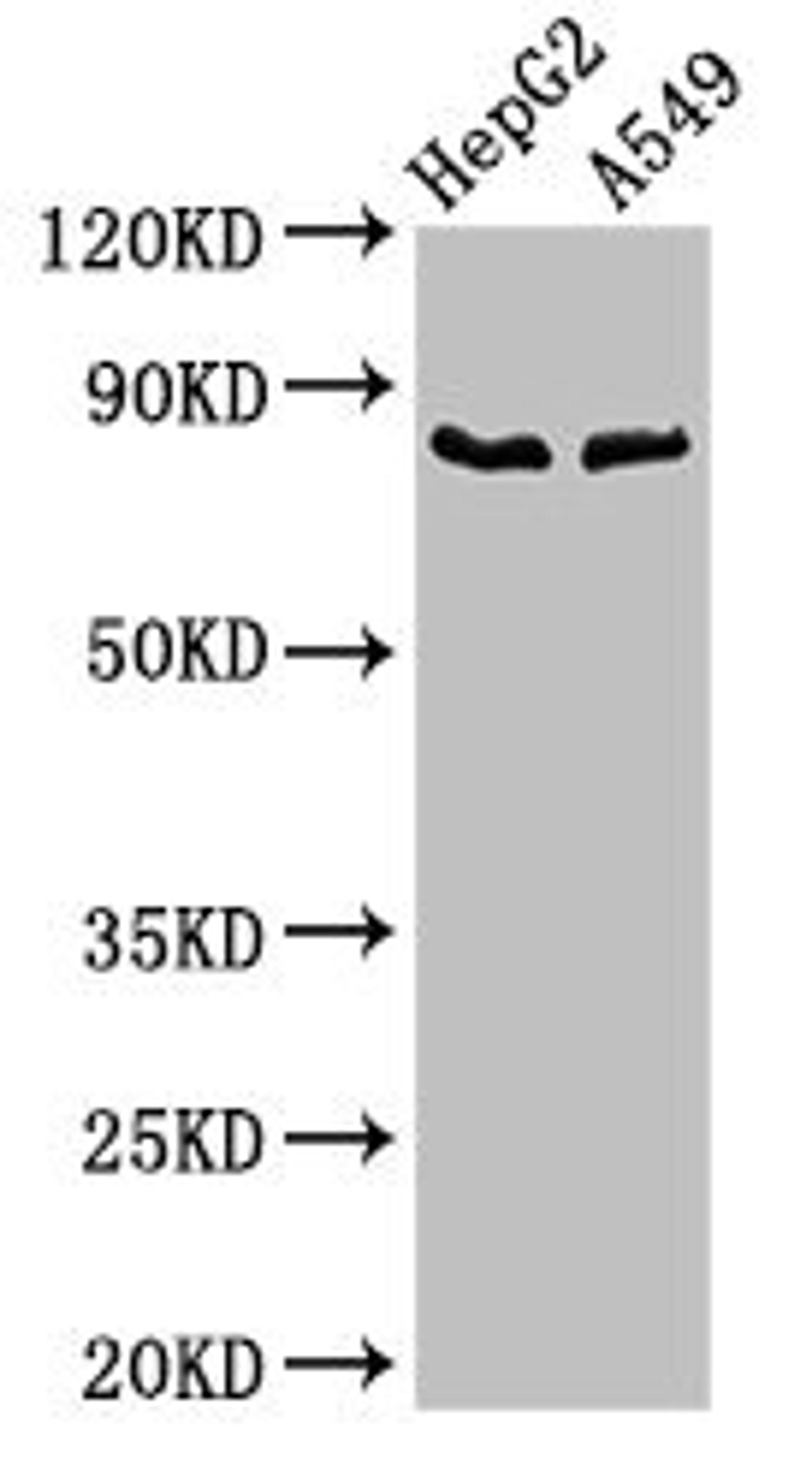 Western Blot. Positive WB detected in: HepG2 whole cell lysate, A549 whole cell lysate. All lanes: CFB antibody at 2.8ug/ml. Secondary. Goat polyclonal to rabbit IgG at 1/50000 dilution. Predicted band size: 86 kDa. Observed band size: 86 kDa.