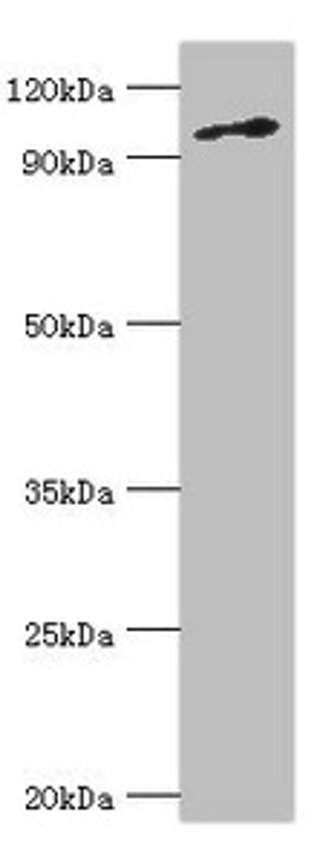Western blot. All lanes: DNA replication licensing factor MCM6 antibody at 3ug/ml + Jurkat whole cell lysate. Secondary. Goat polyclonal to rabbit IgG at 1/10000 dilution. Predicted band size: 93 kDa. Observed band size: 93 kDa. 