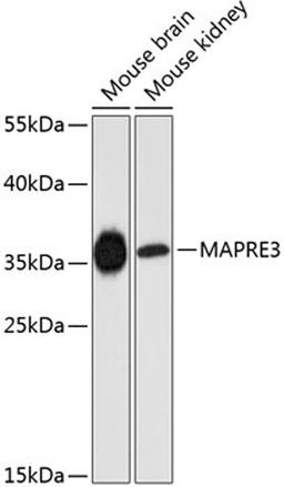 Western blot - MAPRE3 antibody (A9591)