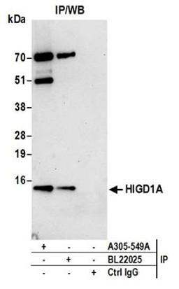 Detection of human HIGD1A by western blot of immunoprecipitates.