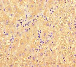 Immunohistochemistry of paraffin-embedded human liver tissue using CSB-PA013632LA01HU at dilution of 1:100