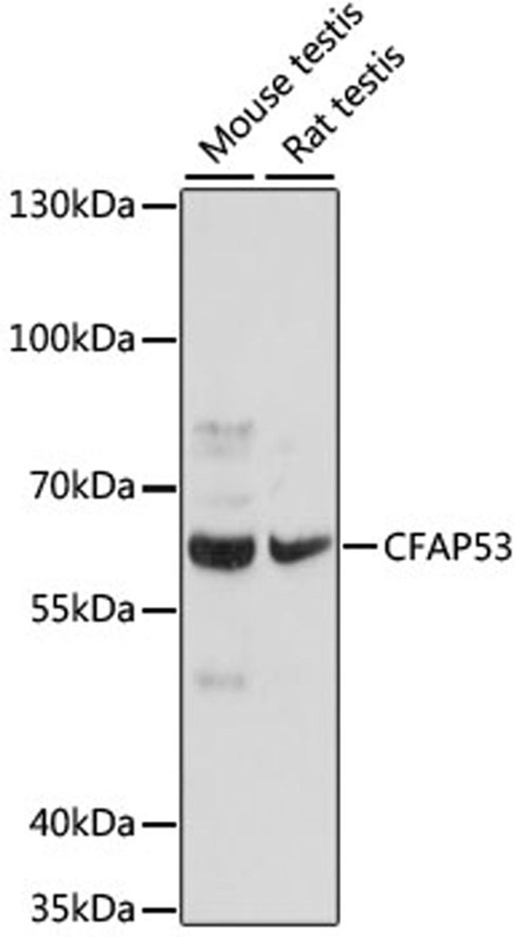 Western blot - CFAP53 antibody (A16607)