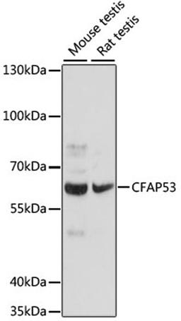 Western blot - CFAP53 antibody (A16607)