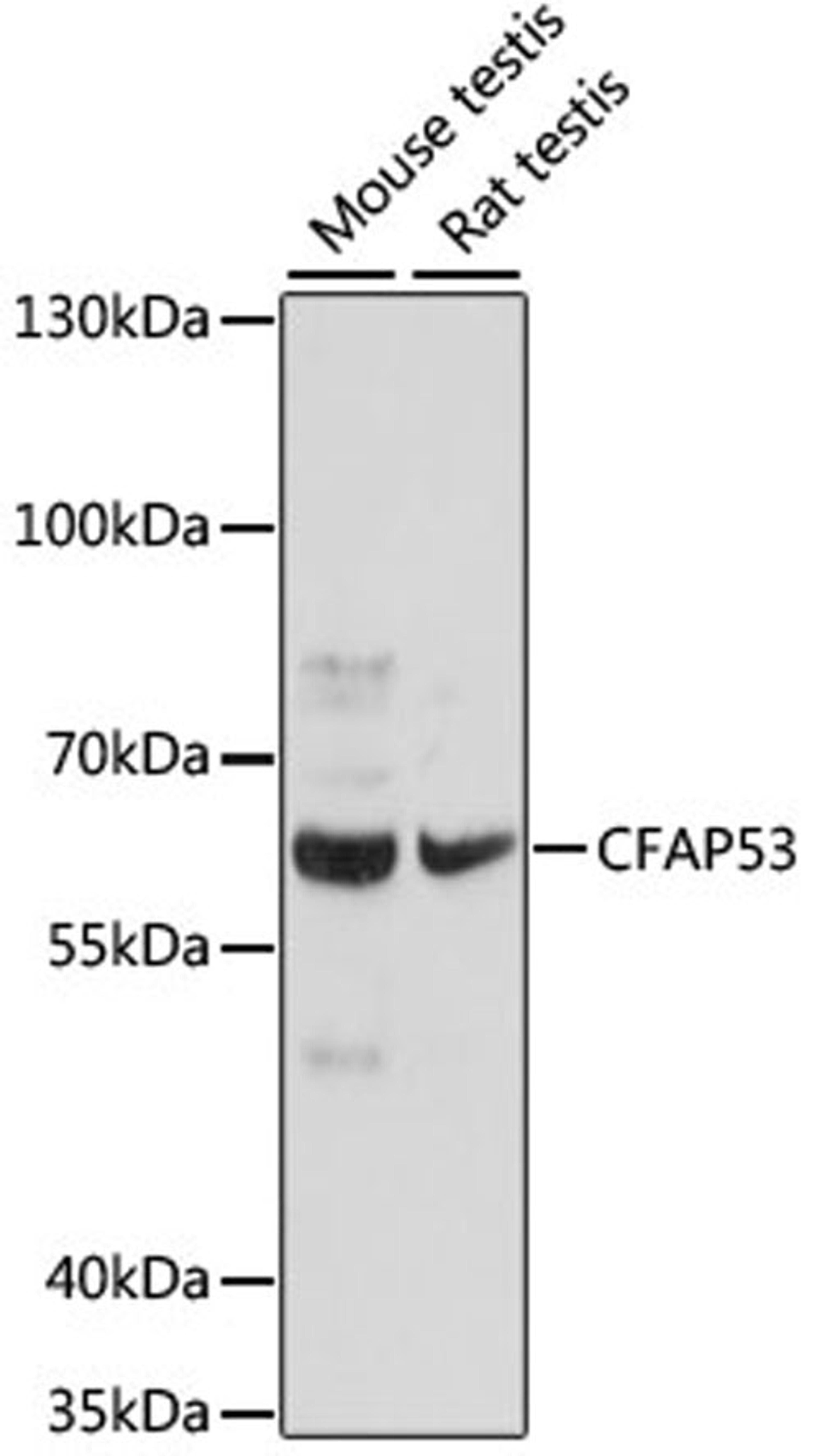 Western blot - CFAP53 antibody (A16607)