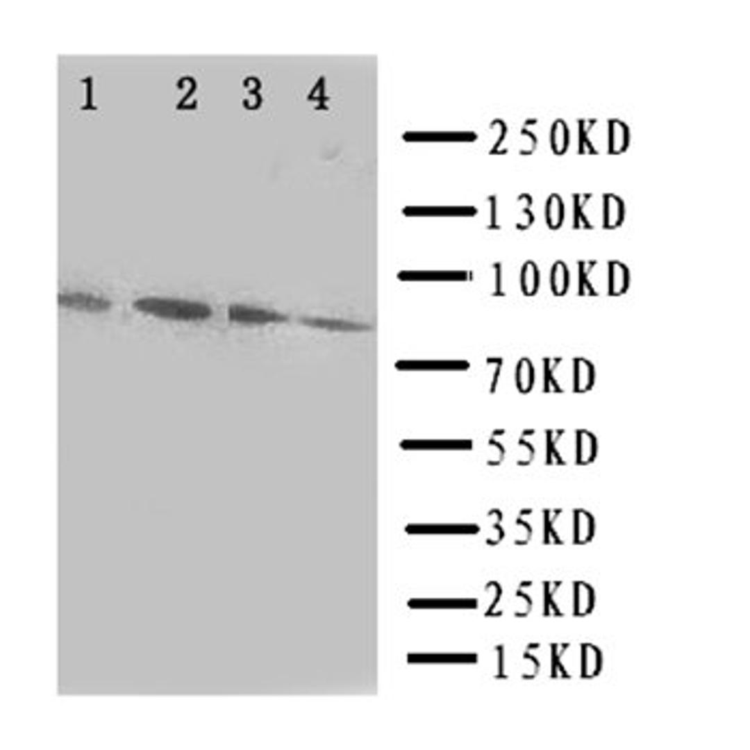 Western blot analysis of Lane 1: Rat Spleen Tissue Lysate, Lane 2: SGC Cell Lysate, Lane 3: HELA Cell Lysate, Lane 4: JURKAT Cell Lysate using SP4 antibody