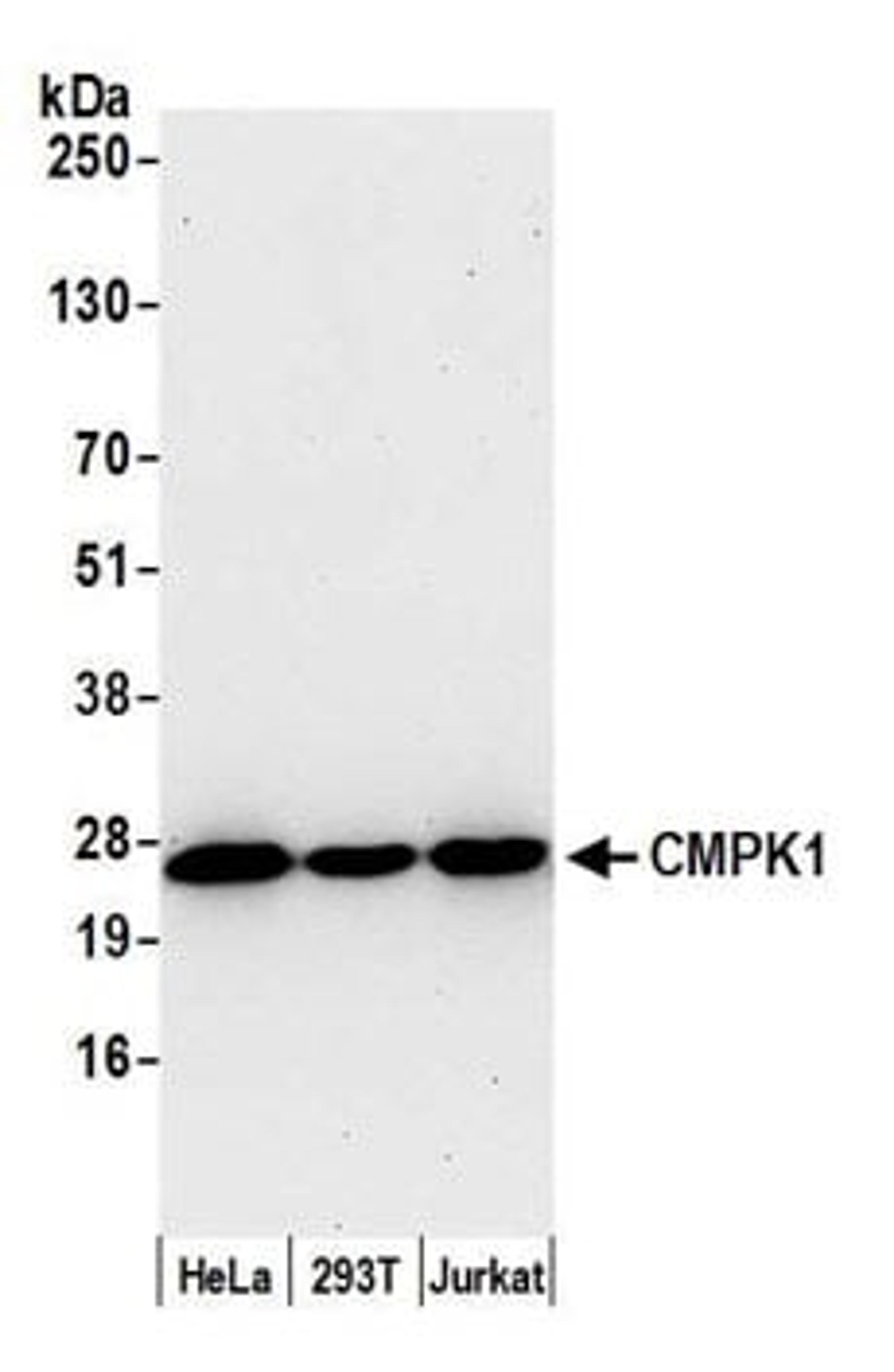 Detection of human CMPK1 by western blot.