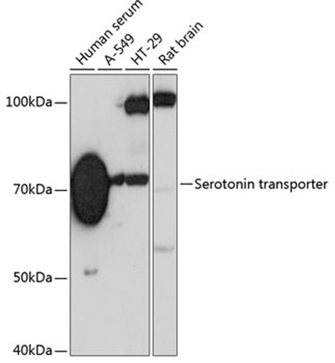 Western blot - Serotonin transporter antibody (A19110)