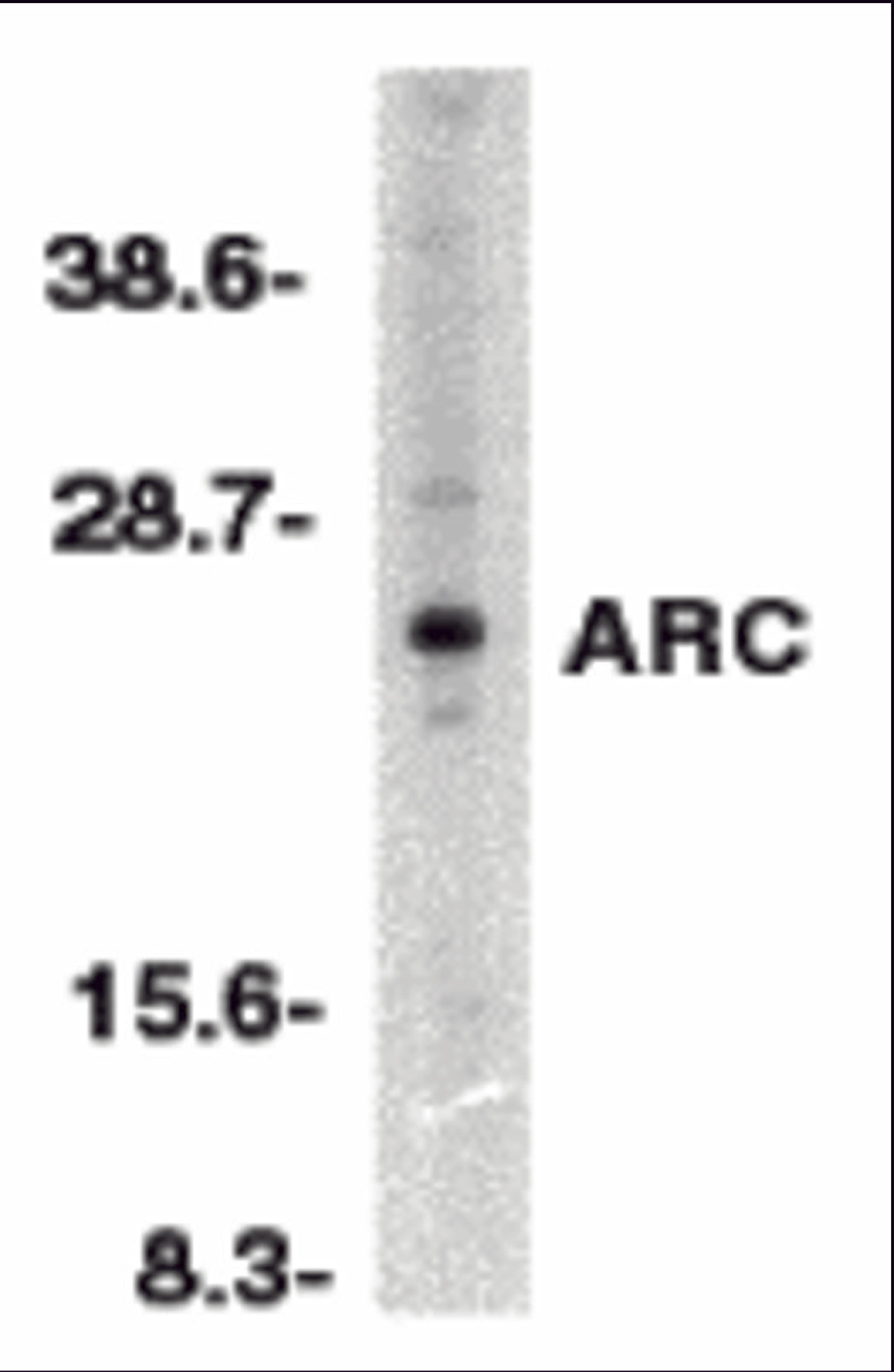 Western blot analysis of ARC in HeLa whole cell lysates with ARC antibody at 1:500 dilution.