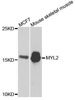 Western blot analysis of extracts of MCF7 cells and mouse tissues using MYL2 antibody