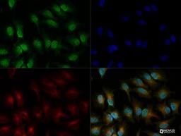 Immunocytochemistry/Immunofluorescence: IRE1 alpha Antibody [NB100-2324] - The IRE-1 alpha antibody was tested in HeLa cells at a 1:200 dilution against Dylight 488 (Green). Alpha tubulin and nuclei were counterstained against Dylight 568 (Red) and DAPI (Blue), respectively.