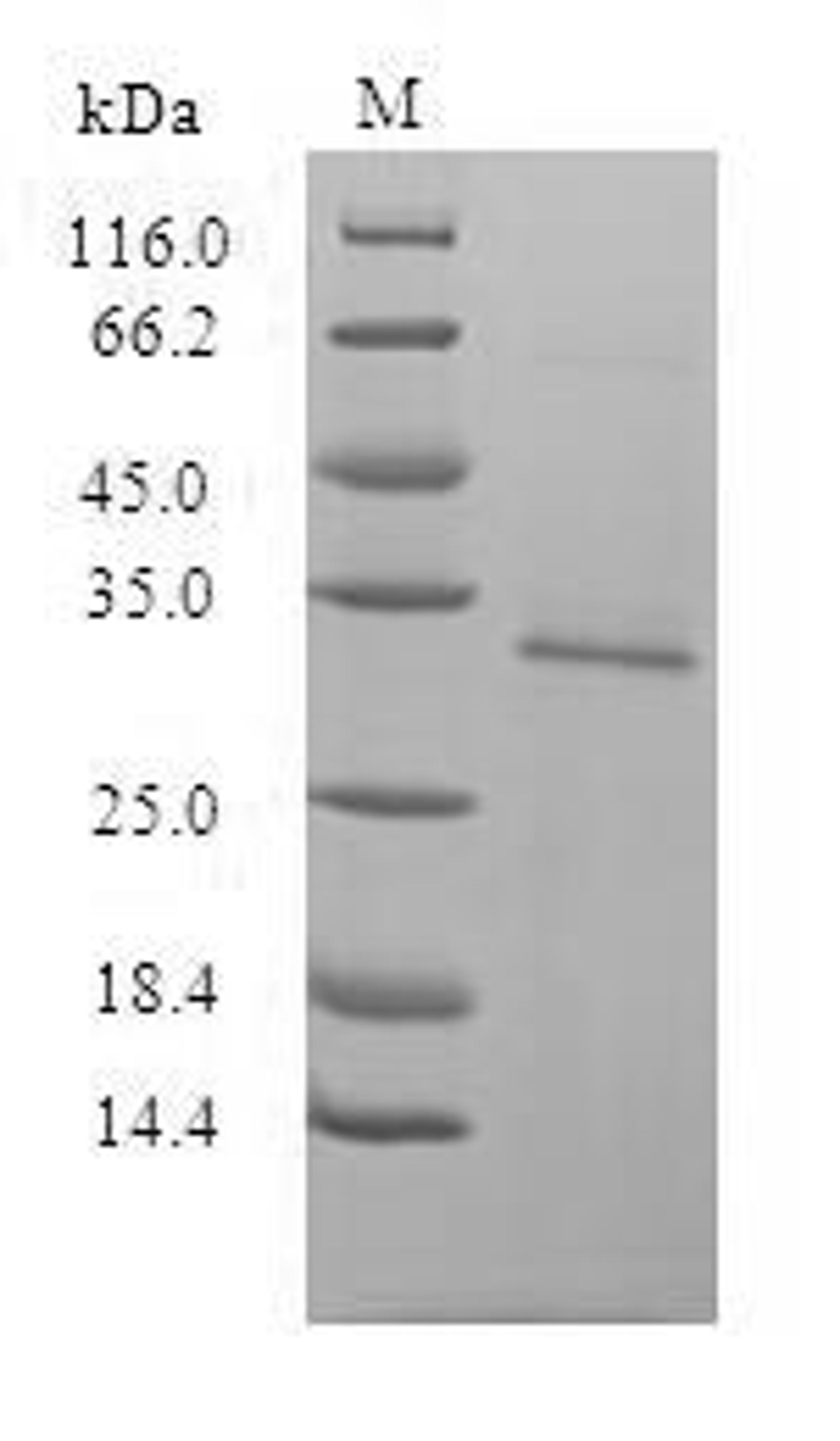 (Tris-Glycine gel) Discontinuous SDS-PAGE (reduced) with 5% enrichment gel and 15% separation gel.