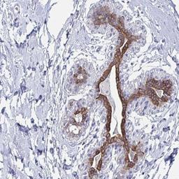 Immunohistochemistry: FAM46D Antibody [NBP2-32454] - Staining of human breast shows strong cytoplasmic positivity in glandular cells.