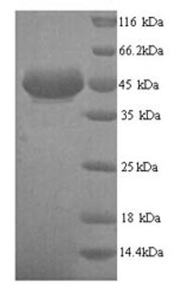 (Tris-Glycine gel) Discontinuous SDS-PAGE (reduced) with 5% enrichment gel and 15% separation gel.