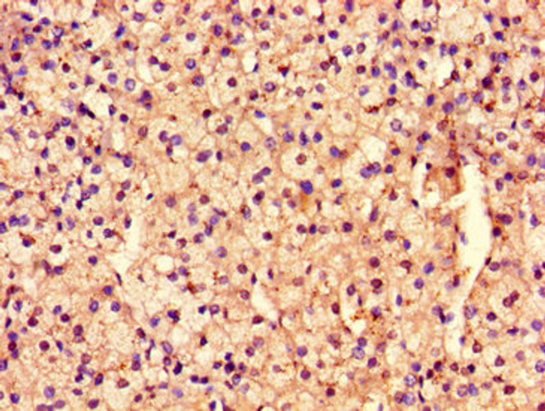 Immunohistochemistry of paraffin-embedded human adrenal gland tissue using CSB-PA868370LA01HU at dilution of 1:100