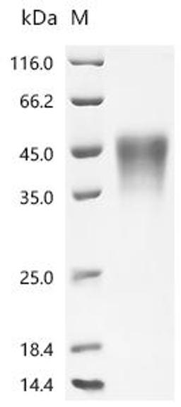(Tris-Glycine gel) Discontinuous SDS-PAGE (reduced) with 5% enrichment gel and 15% separation gel.