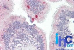 Immunohistochemistry-Paraffin: AP3M1 Antibody [NBP2-27068] - Formalin-fixed, paraffin-embedded human lung (respiratory epithelium) stained with AP3 antibody at 10 ug/ml.