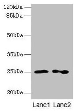 Western blot. All lanes: RAB11B antibody at 2µg/ml. Lane 1: Hela whole cell lysate. Lane 2: Rat gonadal tissue. Secondary. Goat polyclonal to rabbit IgG at 1/10000 dilution. Predicted band size: 25, 20 kDa. Observed band size: 25 kDa