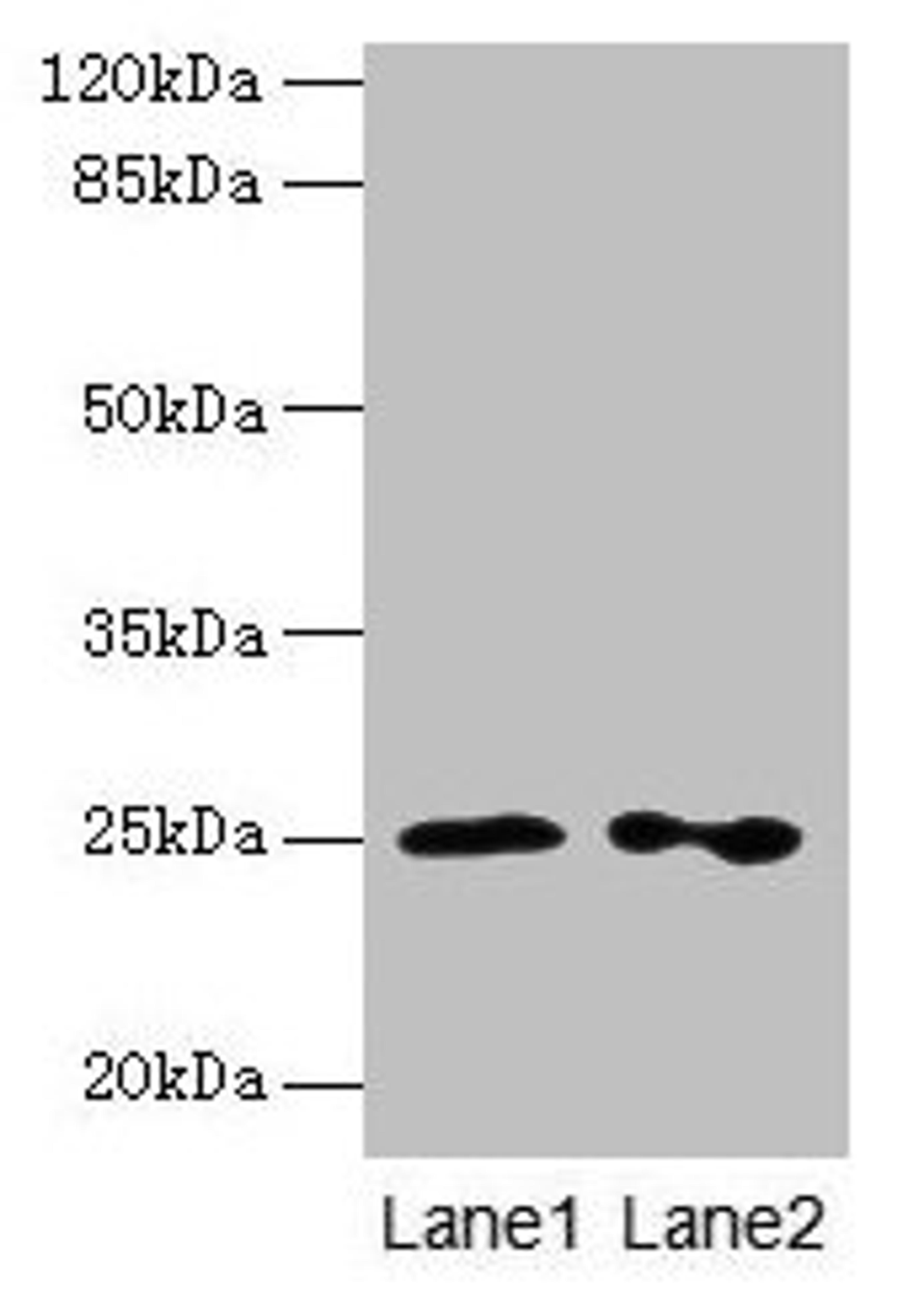 Western blot. All lanes: RAB11B antibody at 2µg/ml. Lane 1: Hela whole cell lysate. Lane 2: Rat gonadal tissue. Secondary. Goat polyclonal to rabbit IgG at 1/10000 dilution. Predicted band size: 25, 20 kDa. Observed band size: 25 kDa