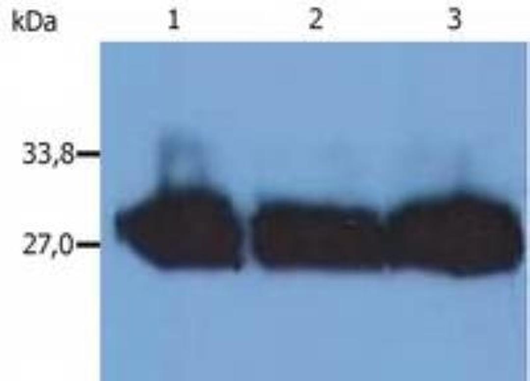 Western Blot: Kappa Light Chain Antibody (MEM-09) [NB500-331] - Fig. 1. Western Blotting analysis (reducing conditions) of human blood sera using anti-human Immunoglobulin kappa-chain (MEM-09).  Lane 1-3: Human blood serum of different healthy donors