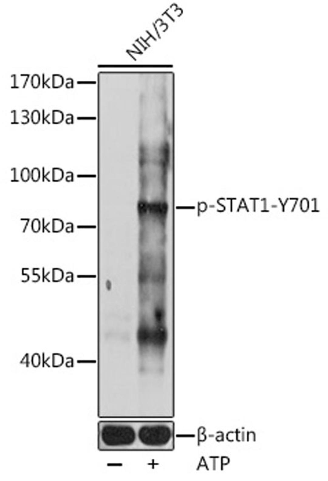 Western blot - Phospho-STAT1-Y701 antibody (AP0858)