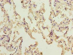 Immunohistochemistry of paraffin-embedded human lung tissue using CSB-PA885775LA01HU at dilution of 1:100