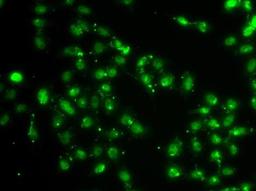 Immunofluorescence analysis of A549 cell using L3MBTL1 antibody