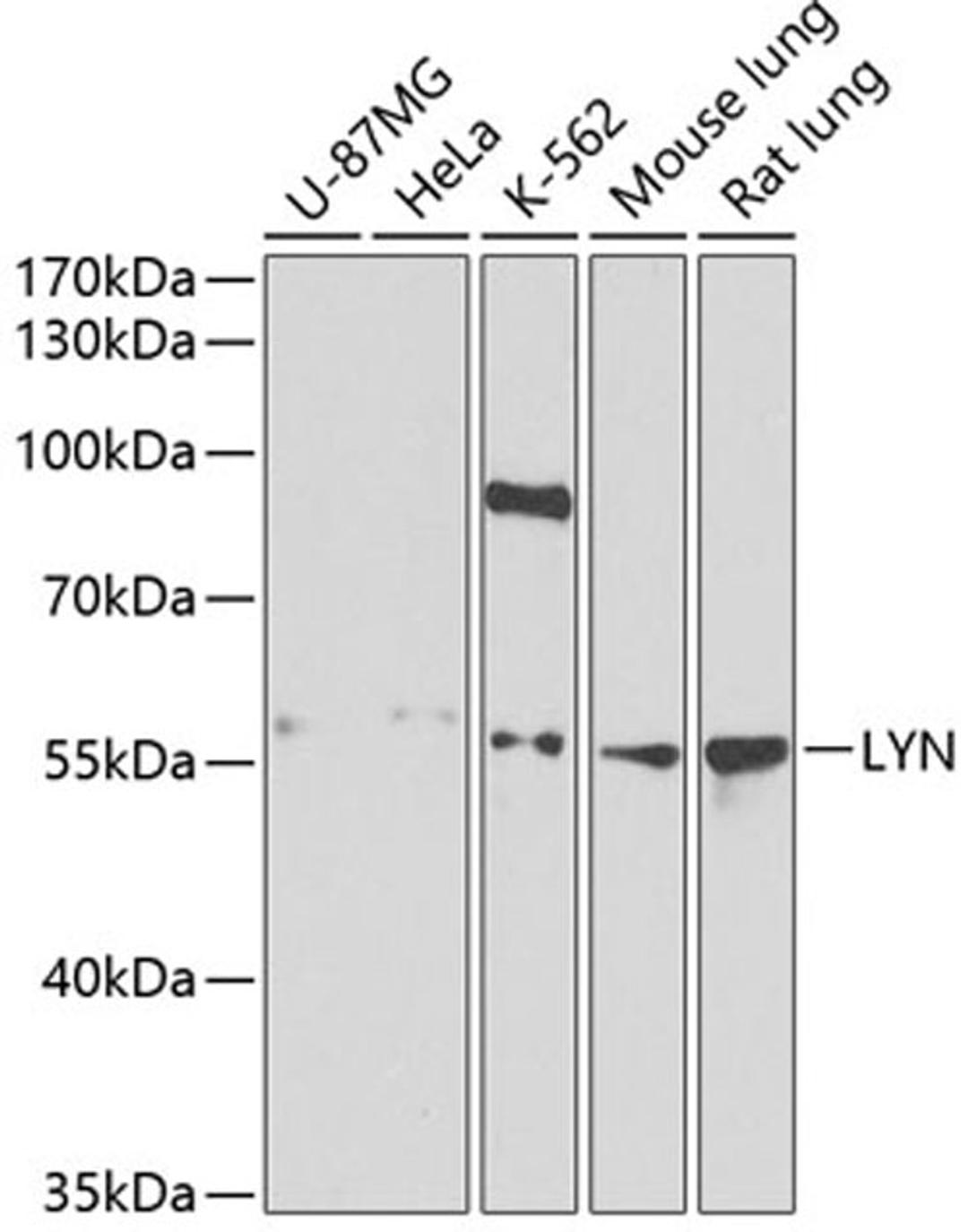 Western blot - LYN antibody (A2093)