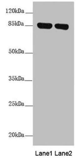 Western blot. All lanes: NDUFS1 antibody at 2.41 ug/ml. Lane 1: Mouse heart tissue. Lane 2: Mouse kidney tissue. Secondary. Goat polyclonal to rabbit IgG at 1/10000 dilution. Predicted band size: 80, 81, 68, 74, 76 kDa. Observed band size: 80 kDa.