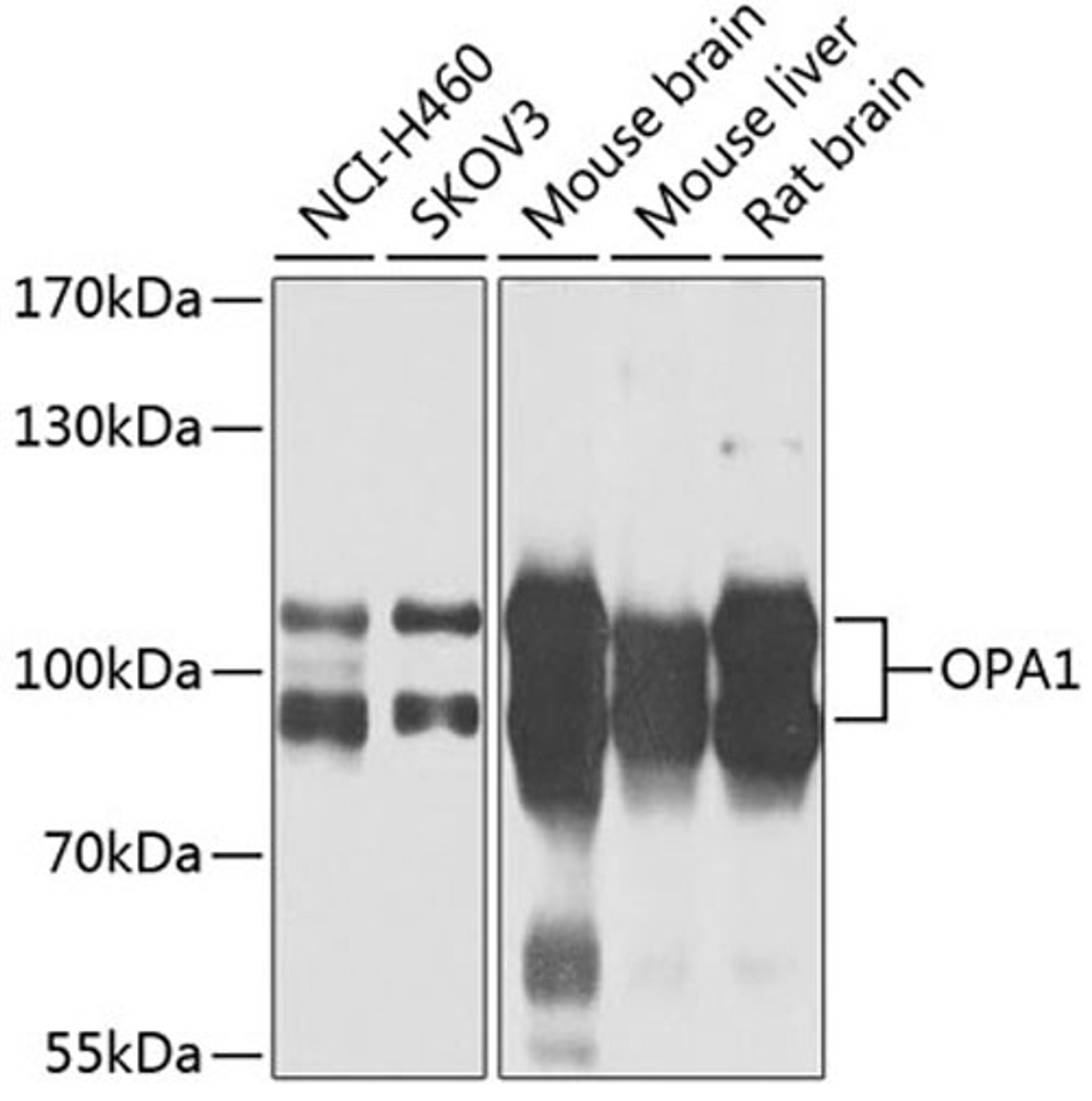 Western blot - OPA1 antibody (A9833)