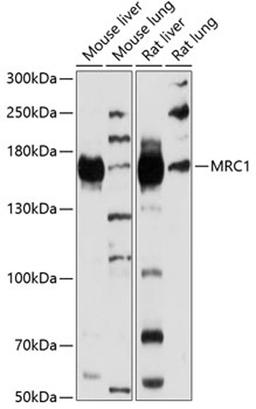 Western blot - MRC1 antibody (A8301)