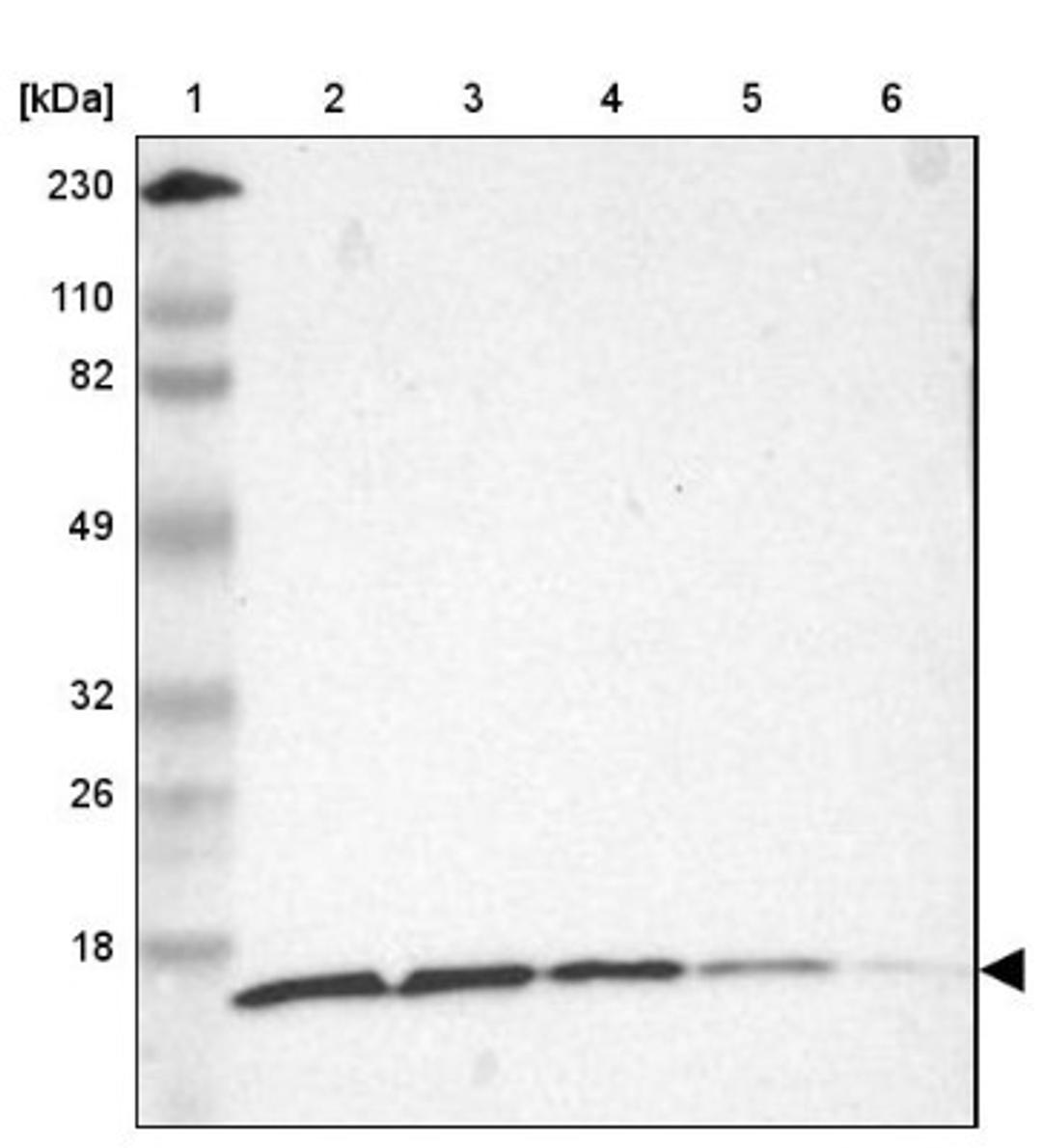 Western Blot: RPS20 Antibody [NBP1-80804] - Lane 1: Marker [kDa] 230, 110, 82, 49, 32, 26, 18<br/>Lane 2: Human cell line RT-4<br/>Lane 3: Human cell line U-251MG sp<br/>Lane 4: Human cell line A-431<br/>Lane 5: Human liver tissue<br/>Lane 6: Human tonsil tissue