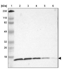 Western Blot: RPS20 Antibody [NBP1-80804] - Lane 1: Marker [kDa] 230, 110, 82, 49, 32, 26, 18<br/>Lane 2: Human cell line RT-4<br/>Lane 3: Human cell line U-251MG sp<br/>Lane 4: Human cell line A-431<br/>Lane 5: Human liver tissue<br/>Lane 6: Human tonsil tissue