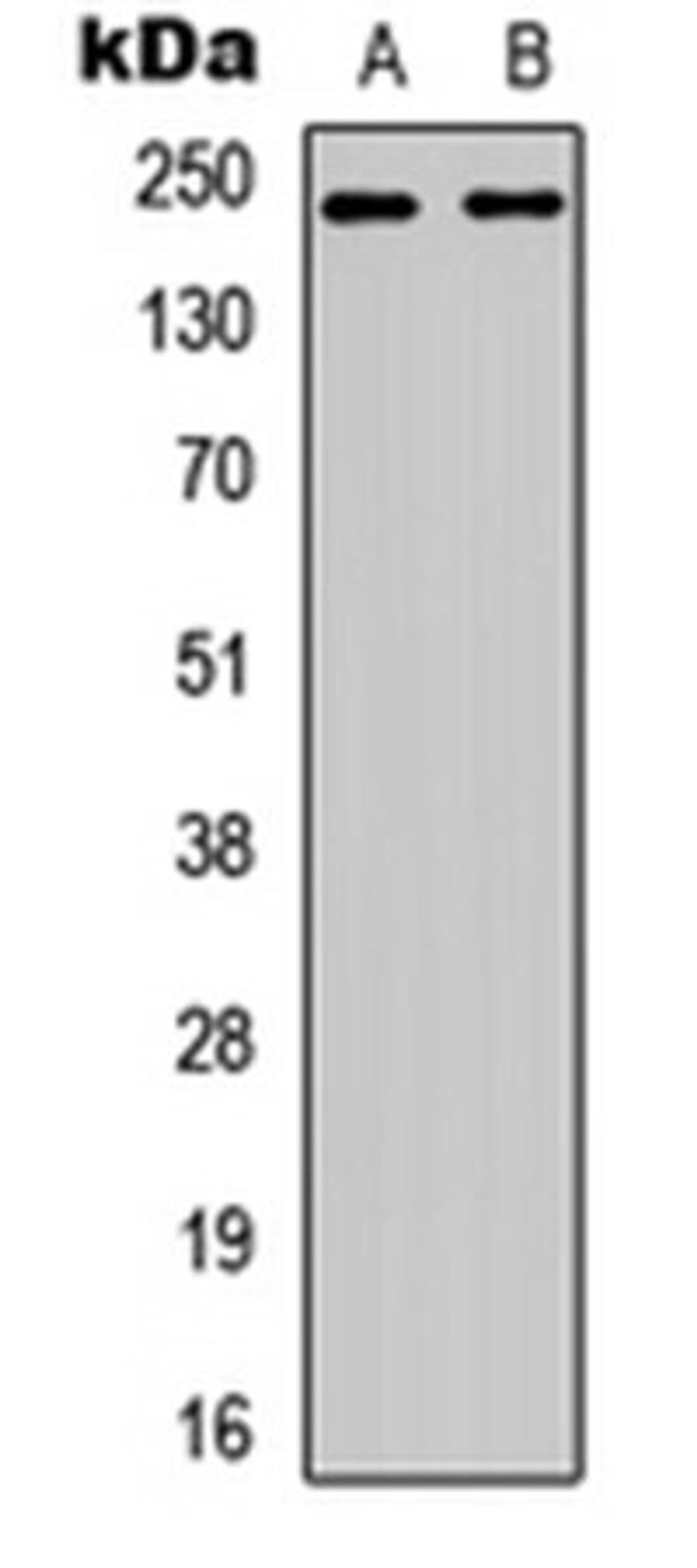 Western blot analysis of HEK293T EGF-treated (Lane 1), Jurkat EGF-treated (Lane 2) whole cell lysates using p65 (phospho-T60) antibody